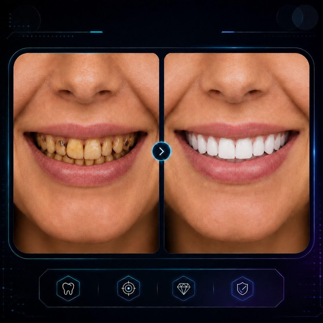 Virtual Smile Simulation